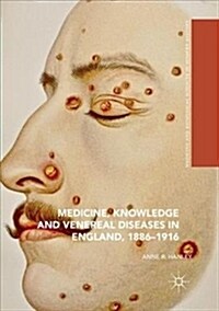 Medicine, Knowledge and Venereal Diseases in England, 1886-1916 (Paperback)