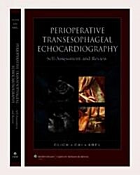 Perioperative Transesophageal Echocardiography (Paperback, 1st)
