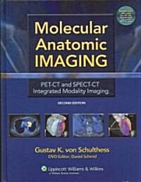Molecular Anatomic Imaging: Pet-CT and Spect-CT Integrated Modality Imaging (Hardcover, 2nd)