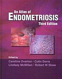 Atlas of Endometriosis (Hardcover, 3 ed)