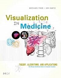Visualization in Medicine (Hardcover, 1st)