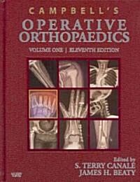 Campbells Operative Orthopaedics (Hardcover, DVD, 11th)