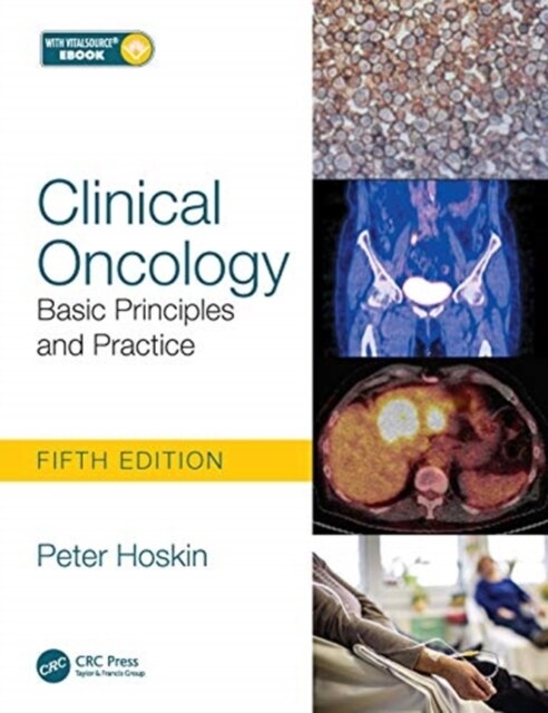 Clinical Oncology : Basic Principles and Practice (Paperback, 5 ed)