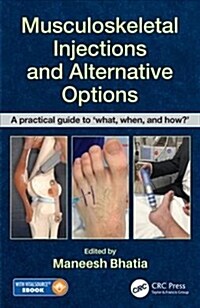 Musculoskeletal Injections and Alternative Options: A Practical Guide to What, When and How? [With eBook] (Paperback)