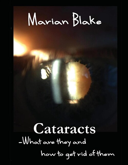 Cataracts: What Are They and How to Get Rid of Them? (Paperback)