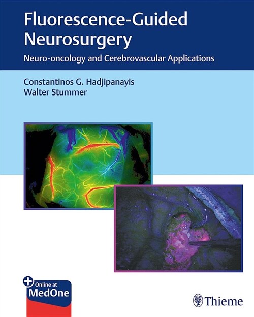 Fluorescence-Guided Neurosurgery: Neuro-Oncology and Cerebrovascular Applications (Hardcover)