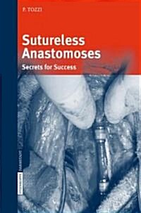 Sutureless Anastomoses: Secrets for Success (Hardcover, 2007)
