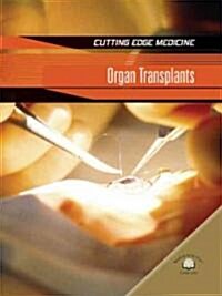 Organ Transplants (Library Binding)