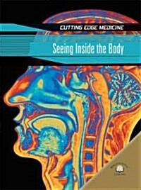 Seeing Inside the Body (Library Binding)