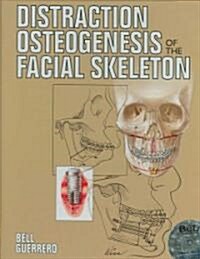 Distraction Osteogenesis of the Facial Skeleton [With CDROM] (Hardcover)