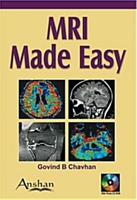 MRI Made Easy (Paperback, CD-ROM)