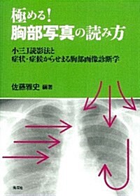 極める!胸部寫眞の讀み方: 小三J讀影法と症狀·症候からせまる胸部畵像診斷學 (單行本)