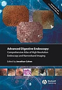 Comprehensive Atlas of High Resolution Endoscopy and Narrowband Imaging (Hardcover)
