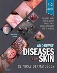 Andrews' diseases of the skin : clinical dermatology. 13th ed
