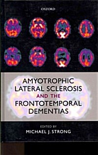 Amyotrophic Lateral Sclerosis and the Frontotemporal Dementias (Hardcover)
