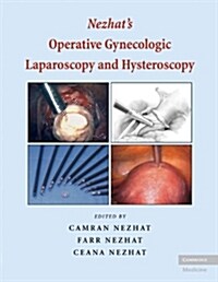 Nezhats Operative Gynecologic Laparoscopy and Hysteroscopy : Principles and Techniques (Hardcover, 3 Rev ed)