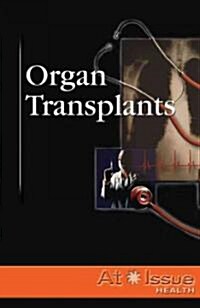 Organ Transplants (Library)