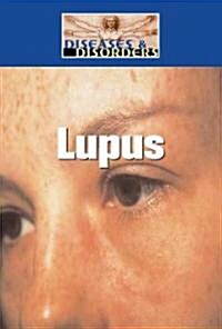 Lupus (Library Binding)