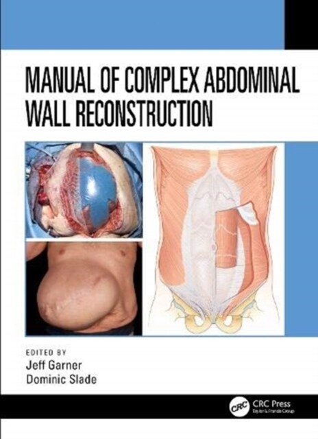 Manual of Complex Abdominal Wall Reconstruction (Hardcover)