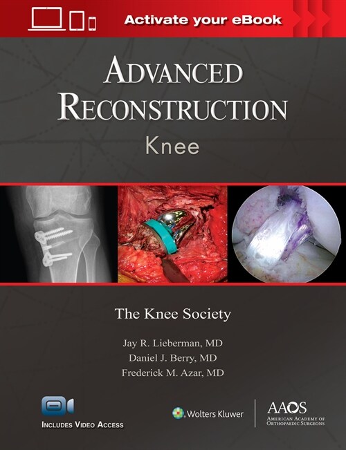 Advanced Reconstruction: Knee: Print + eBook with Multimedia (Hardcover)