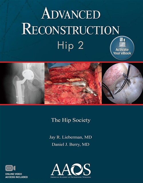 Advanced Reconstruction: Hip 2: Print + eBook with Multimedia (Paperback)