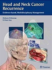 Head and Neck Cancer Recurrence: Evidence-Based, Multidisciplinary Management (Hardcover)