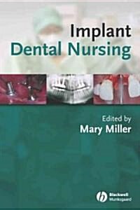 Implant Dental Nursing (Paperback)
