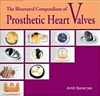The Illustrated Compendium of Prosthetic Heart Valves [With CDROM] (Hardcover)