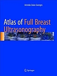 Atlas of Full Breast Ultrasonography (Paperback, Softcover Repri)