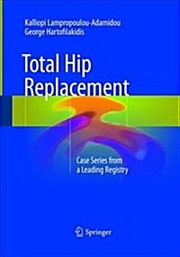 Total Hip Replacement: Case Series from a Leading Registry (Paperback, Softcover Repri)