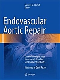 Endovascular Aortic Repair: Current Techniques with Fenestrated, Branched and Parallel Stent-Grafts (Paperback, Softcover Repri)