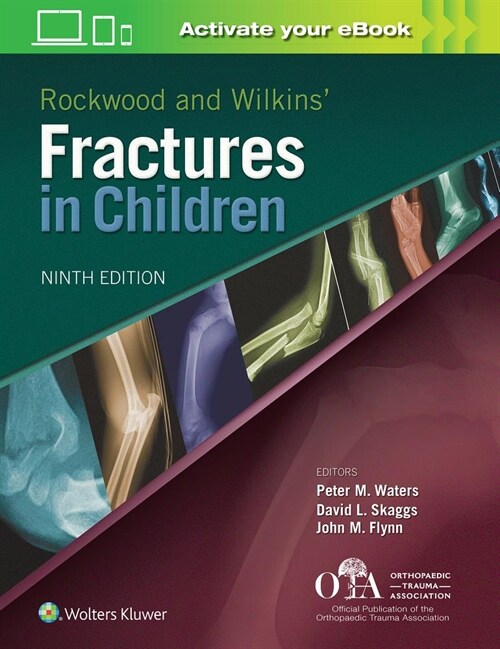 Rockwood and Wilkins Fractures in Children (Hardcover)