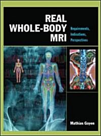 Real Whole-Body MRI: Requirements, Indications, Perspectives: Requirements, Indications, Perspectives (Hardcover)