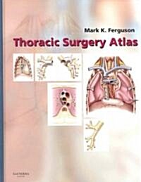 Thoracic Surgery Atlas (Hardcover)