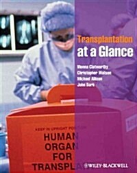 Transplantation at a Glance (Paperback, 2)
