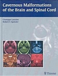 Cavernous Malformations of the Brain and Spinal Cord (Hardcover, 1st)