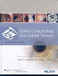 Eyelid, Conjunctival, and Orbital Tumors and Intraocular Tumors: An Atlas and Text (Two-Volume Set) (Hardcover, 2)