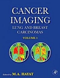 Cancer Imaging: Lung and Breast Carcinomas (Hardcover)