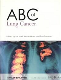 ABC of Lung Cancer (Paperback)