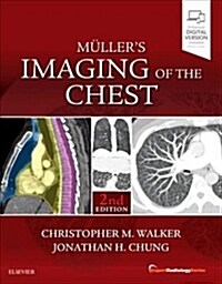 Mullers Imaging of the Chest: Expert Radiology Series (Hardcover, 2)