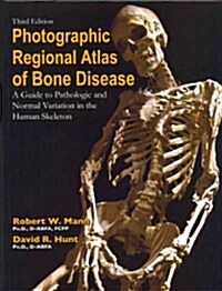 Photographic Regional Atlas of Bone Disease: A Guide to Pathologic and Normal Variation in the Human Skeleton (Hardcover, 3)