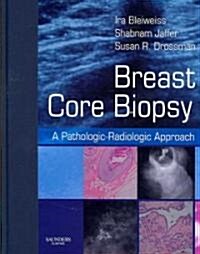Breast Core Biopsy (Hardcover, 1st)