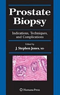 Prostate Biopsy: Indications, Techniques, and Complications (Hardcover)