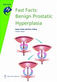 Fast Facts: Benign Prostatic Hyperplasia (Paperback, 7th edition)