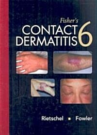 Fishers Contact Dermatitis (Hardcover, 6th)