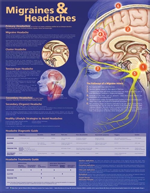 Migraines and Headaches Anatomical Chart (Other, 2)