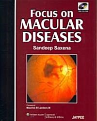 Focus on Macular Diseases (Hardcover, 1st)