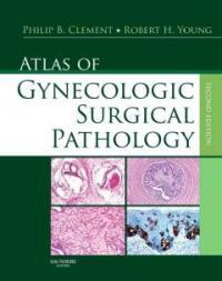 Atlas of gynecologic surgical pathology 2nd ed