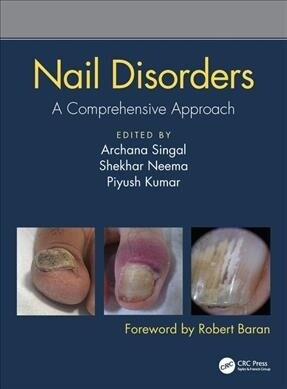 Nail Disorders: A Comprehensive Approach (Hardcover)
