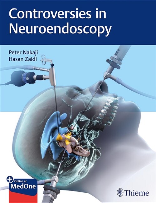 Controversies in Neuroendoscopy (Hardcover)